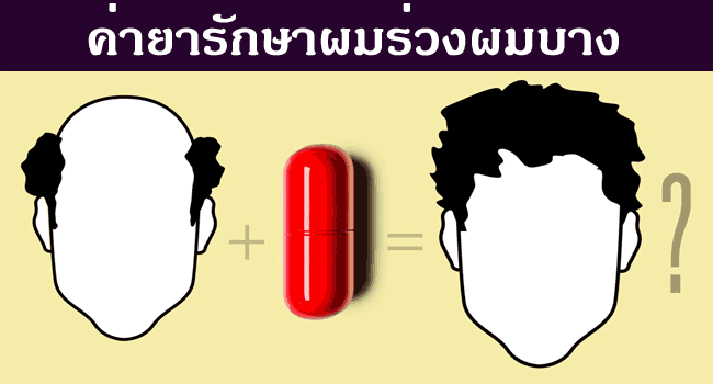 ค่าใช้จ่ายในการรักษาผมร่วง ผมบาง ราคาค่ายาปลูกผม