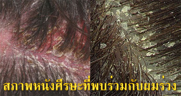 หัว เป็น แผล