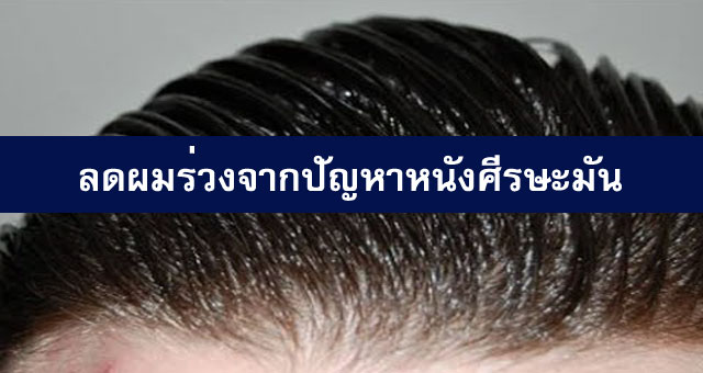 หนังศีรษะมันและผมร่วงเกี่ยวข้องกันอย่างไร