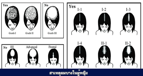 ผมร่วง ผมบาง ใช้อะไรดี