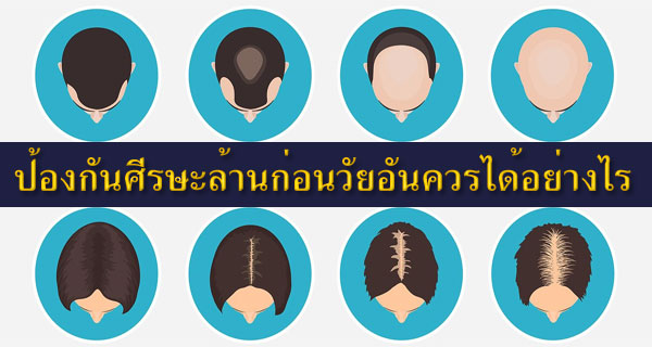 กฎเหล็ก 6 ข้อเพื่อป้องกันศีรษะล้านก่อนวัยอันควร แนะนำโดย ไทยแฮร์เซ็นเตอร์