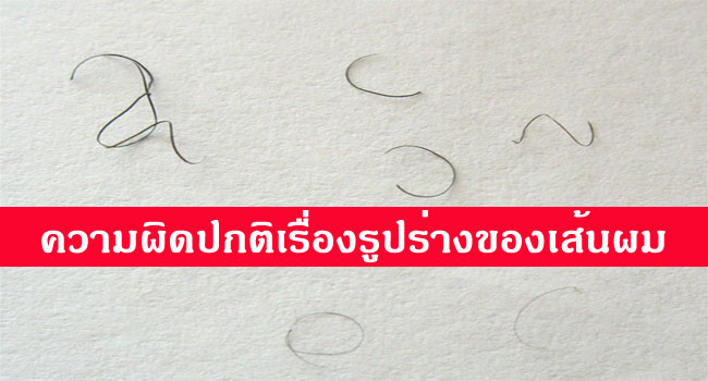 ความผิดปกติเรื่องรูปร่างของเส้นผม