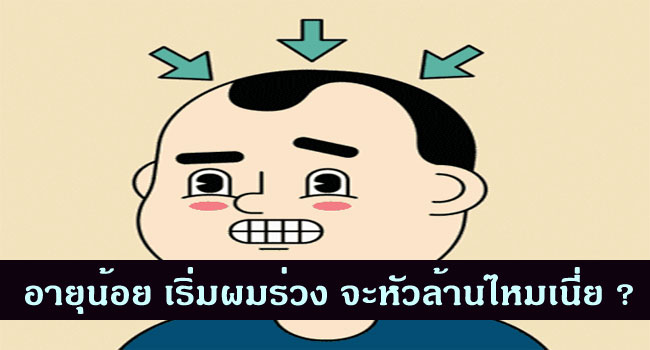 ผมร่วงมากทำไงดี ? ทำยังไงดีไม่ให้ผมร่วง ?