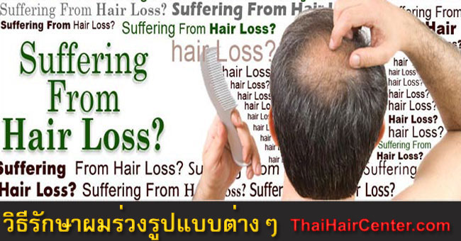 วิธีการรักษาผมร่วงผมบางและผลการรักษาอาการผมร่วงของแต่ละสาเหตุ